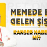 Memede Ele Gelen Şişlik Kanser Habercisi mi?
