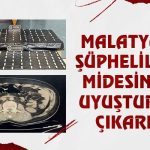 Malatya’da Şüphelilerin Midesinden Uyuşturucu Çıkarıldı