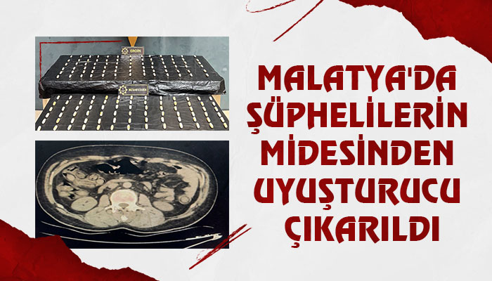 Malatya’da Şüphelilerin Midesinden Uyuşturucu Çıkarıldı